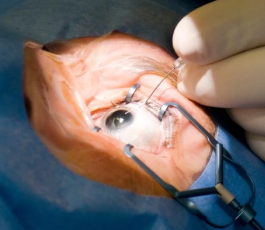 Cataract Doctor in Astana
