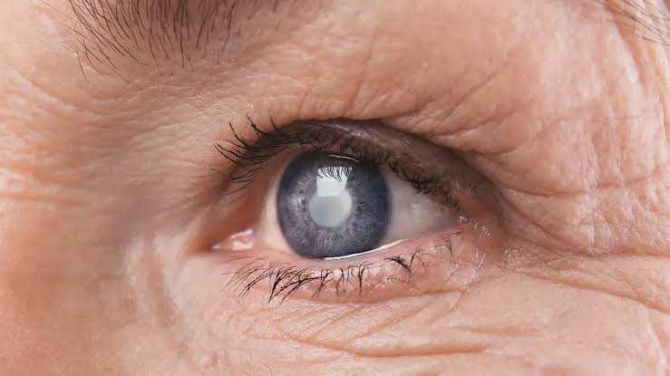 Treatment Kala Pani For Eyes