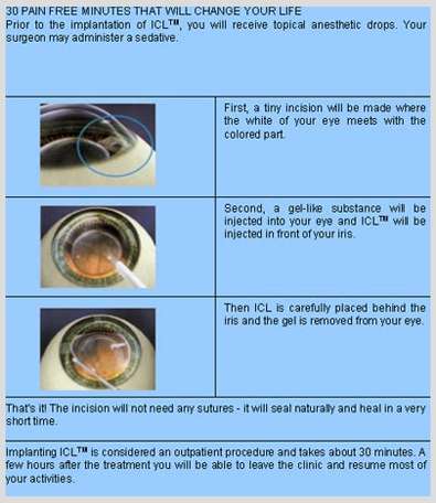 Implantable Contact Lens-ICL in Delhi