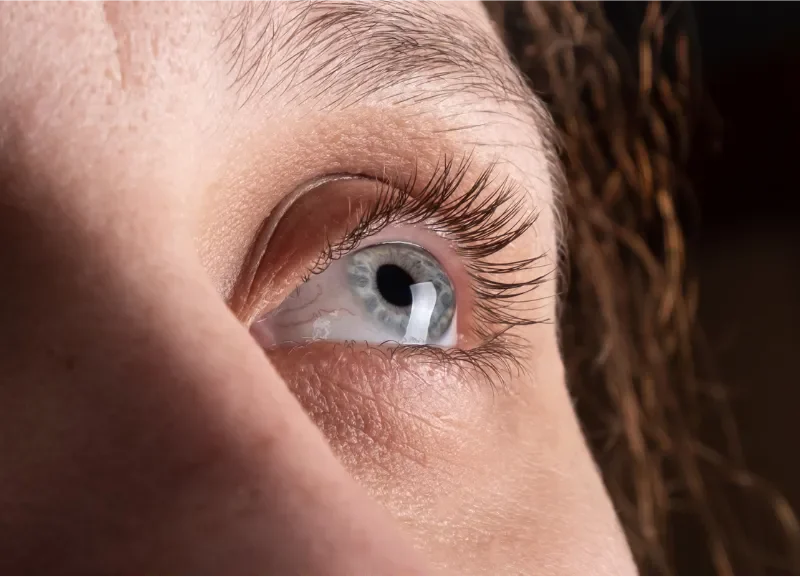 keratoconus at Best Eye Hospital in East Delhi