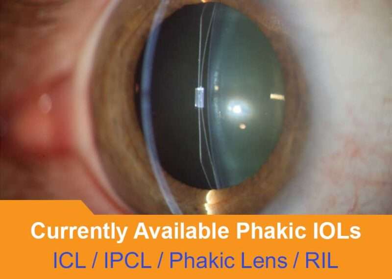 Implantable Contact Lens, ICL Surgery in Delhi, Implantable Collamer Lens