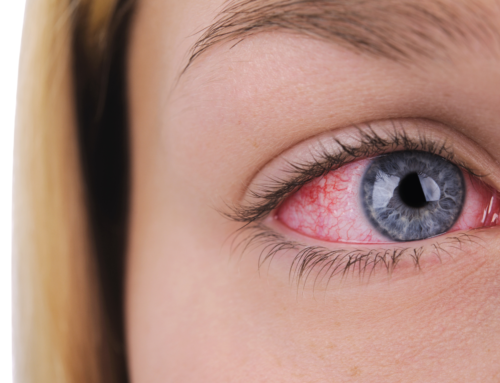 What is Corneal Abrasion? Symptoms, Treatment and Precautions