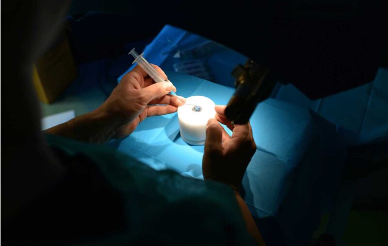 The Benefits and Risks of Corneal Transplant Surgery: A Balanced View